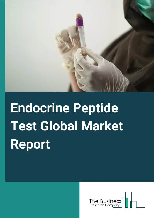Endocrine Peptide Test Global Market Report 2025 – By Test-Type (Dehydroepiandrosterone Sulphate, Progesterone, Luteinizing Hormone, Thyroid Prolactin, Oestradiol, Human Chorionic Gonadotropin, Thyroid-Stimulating Hormon...