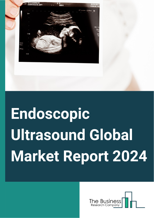 Endoscopic Ultrasound Global Market Report 2025 – By Product (Endoscope, Ultrasound Probe, Needle, Accessories, Ultrasonic Processors, Other Products), By Application (Gastrointestinal Cancer, Lung Cancer, Pancreaticobil...