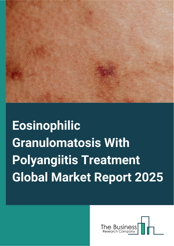 Global Eosinophilic Granulomatosis With Polyangiitis Treatment Market Report 2025