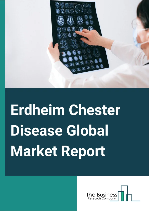 Erdheim Chester Disease Global Market Report 2024 – By Treatment (Chemotherapy, Immunotherapy, Radiation Therapy, Other Treatments), By Route of Administration (oral, Parenteral, Other Route Of Administration), By Distribution Channel (Hospital Pharmacy, Online Pharmacy, Retail Pharmacy), By End User (Hospitals, Homecare, Specialty Clinics, Other End User) – Market Size, Trends, And Global Forecast 2024-2033