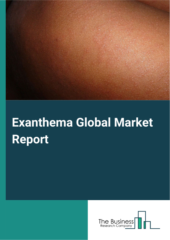 Exanthema