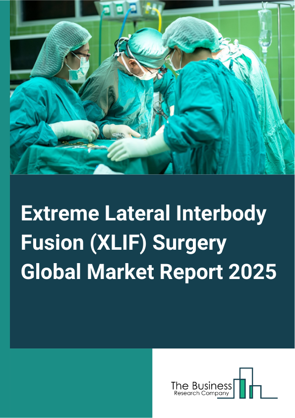 Global Extreme Lateral Interbody Fusion (XLIF) Surgery  Market Report 2025