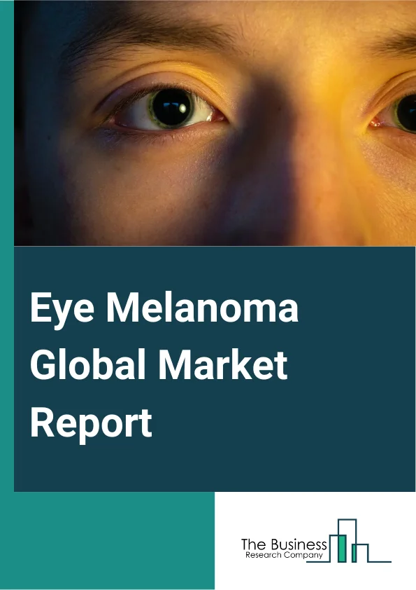 Eye Melanoma Global Market Report 2024 – By Site (Uvea, Sclera, Retina), By Diagnosis (Imaging, Biopsy, Eye Exam), By Treatment (Surgery, Radiation Therapy, Targeted Therapy, Immunotherapy, Other Treatment), By End User (Hospitals And Clinics, Academic Institutes) – Market Size, Trends, And Global Forecast 2024-2033