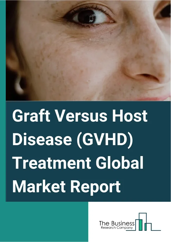 Graft Versus Host Disease (GVHD) Treatment Global Market Report 2025 – By Product Type (Corticosteroids, Monoclonal Antibodies, Immunosuppressants, Others), By Disease Type (Acute GvHD, Prophylaxis GvHD, Chronic GvHD), B...