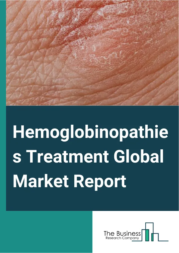 Hemoglobinopathies Treatment Global Market Report 2025 – By Treatment (Stem Cell Therapy, Blood Transfusion), By Application (Thalassemia, Sick Cell Anemia), By Distribution Channel (Hospital Pharmacy, Online Providers, ...