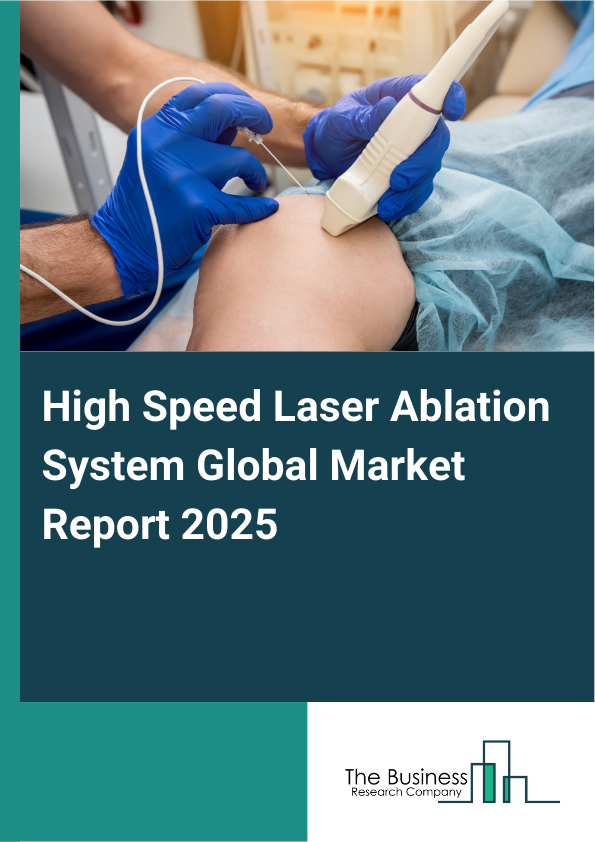 High Speed Laser Ablation System Market Report Infographic Image