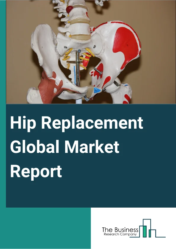 Hip Replacement Global Market Report 2024 – By Procedure (Total Hip Replacement, Partial Hip Replacement, Revision Hip Replacement, Hip Resurfacing), By Material (Metal-On-Metal, Metal-On-Polyethylene, Ceramic-On-Polyethylene, Ceramic-On-Metal, Ceramic-On-Ceramic), By End-User (Hospitals, Specialty Clinics, Ambulatory Surgery Centers) – Market Size, Trends, And Global Forecast 2024-2033