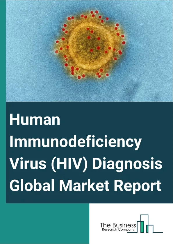 Human Immunodeficiency Virus (HIV) Diagnosis Global Market Report 2025 – By Product (Consumables, Instruments, Software And Services), By Mode (Self-Test, Lab-Based), By End User (Diagnostic Laboratories, Hospitals, Research Institutions) – Impact of Tariff and Trade War on Market Size, Growth, Trends, and Forecast 2025–2034