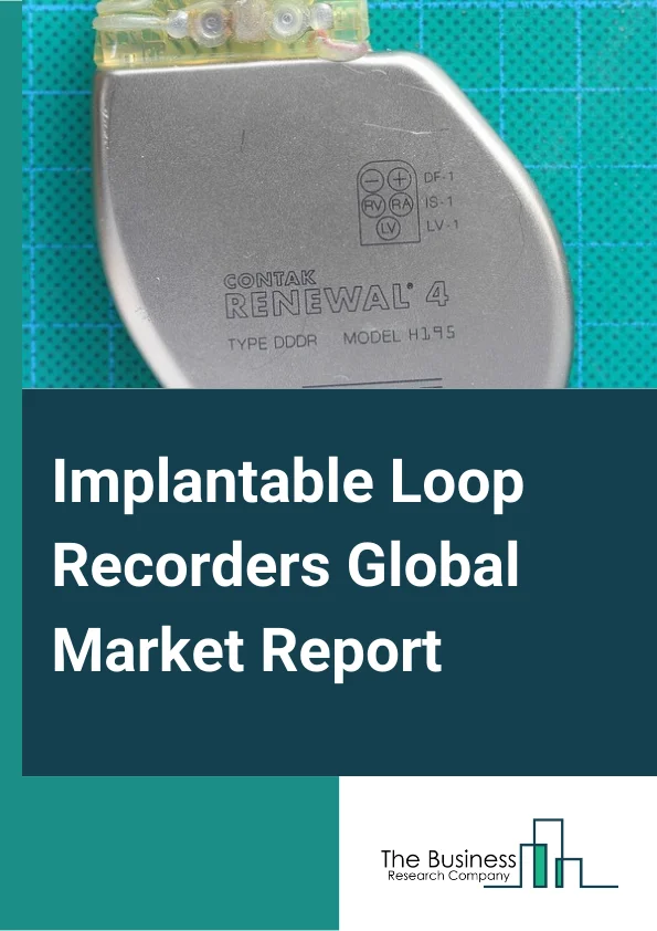 Implantable Loop Recorders Global Market Report 2024 – By Product (Manual, Automatic), By Application (Atrial fibrillation, Cardiac Arrhythmia, Cardiac Syncope), By End Users (Hospitals, Cardiac Centers and Clinics, Ambulatory Surgical Centers) – Market Size, Trends, And Global Forecast 2024-2033