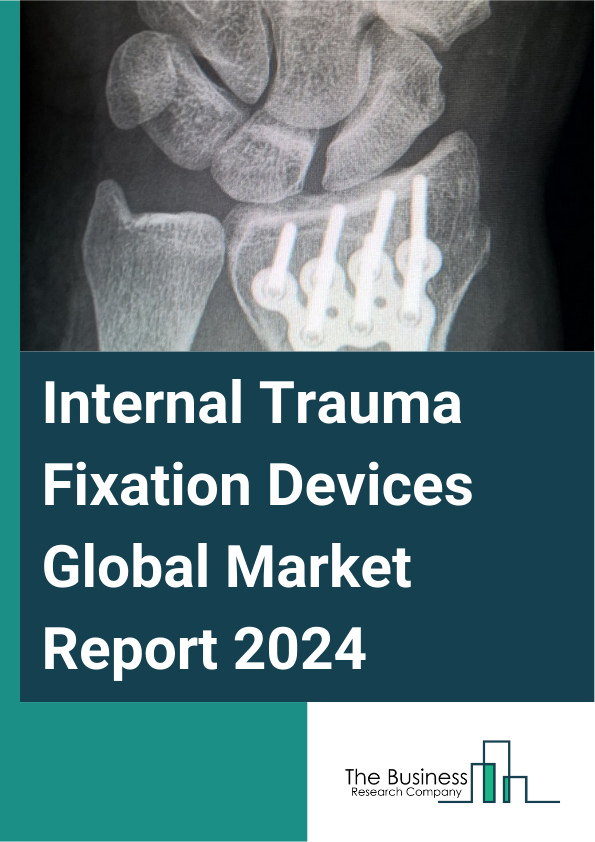 Global Internal Trauma Fixation Devices Market Report 2025