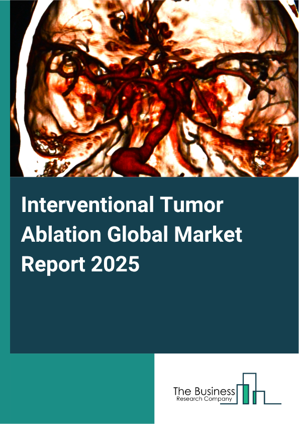 Interventional Tumor Ablation Market Report Infographic Image