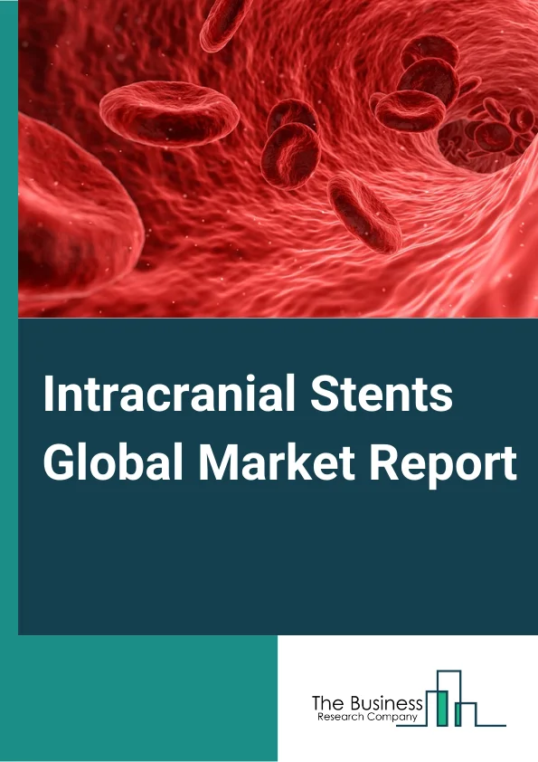 Intracranial Stents