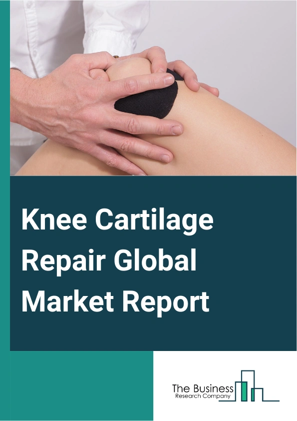 Knee Cartilage Repair Global Market Report 2025 – By Device Type (Implants, Osteotomy, Bone Grafts, Arthroscopy, Resurfacing, Arthrodesis, Other Devices), By Application (Arthroscopic Chondroplasty, Autologous Chondrocyte Implantation, Cell-Based Cartilage Resurfacing, Osteochondral Grafts Transplantation, Other Applications), By End User (Hospitals, Ambulatory Surgical Centers, Orthopedic Clinics) – Impact of Tariff and Trade War on Market Size, Growth, Trends, and Forecast 2025–2034