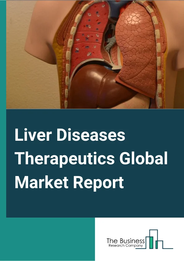 Liver Diseases Therapeutics Global Market Report 2025 – By Disease Type( Hepatitis, Non-Alcoholic Fatty Liver Disease, Alcohol-Induced, Liver Cancer ), By Treatment( Antiviral, Vaccines, Chemotherapy, Immunosuppressive A...