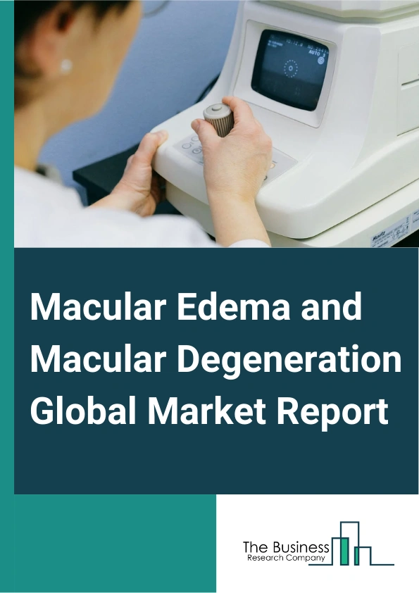 Macular Edema and Macular Degeneration Global Market Report 2025 – By Treatment Type (Drug Therapy, Laser Treatment), By Application (Macular Edema, Diabetic Macular Edema (DME), Cystoid Macular Edema (CME), Macular Degeneration, Dry age-related macular degeneration, Wet age-related macular degeneration), By End User (Hospitals, Clinics, Other End Users) – Market Size, Trends, And Global Forecast 2025-2034