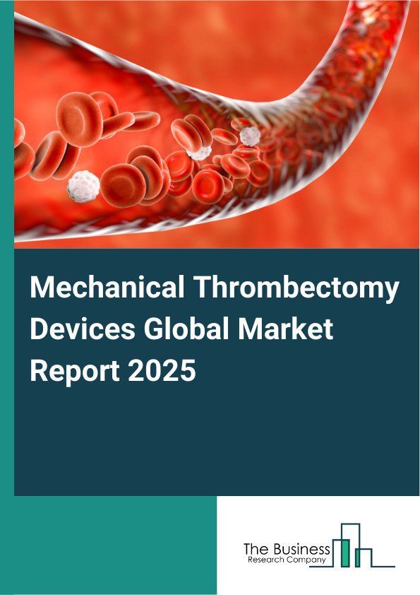 Mechanical Thrombectomy Devices Market Report Infographic Image