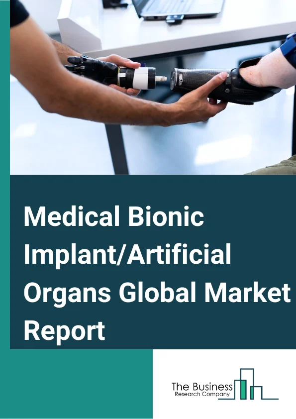 Medical Bionic Implant/Artificial Organs Global Market Report 2024 – By Type( Bionic Implants, Artificial Organs ), By Method Of Fixation( Implantable, Externally Worn ), By Technology( Electronic, Mechanical ), By Application( Hospitals, Clinics, Research and Academic Institutes, Other Applications ) – Market Size, Trends, And Global Forecast 2024-2033