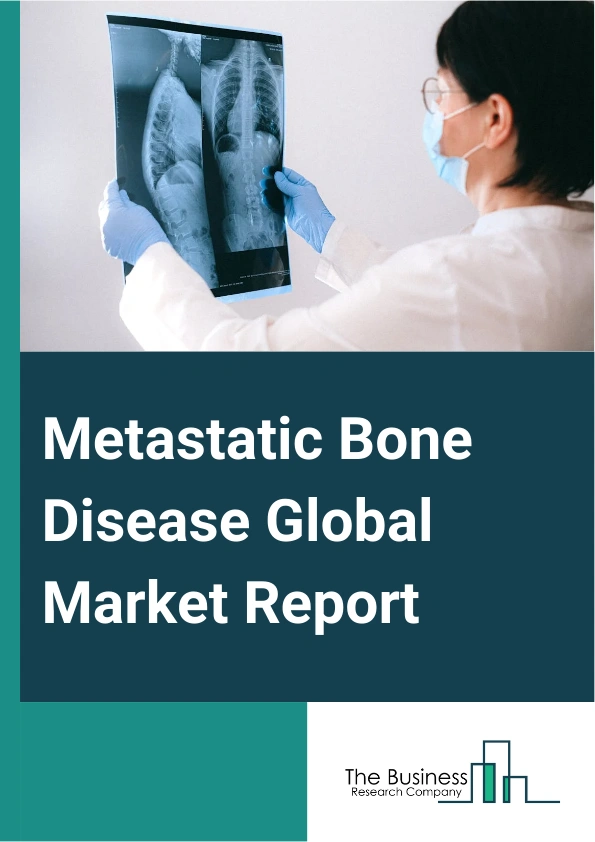 Metastatic Bone Disease Global Market Report 2025 – By Treatment (Medication, Radiation Therapy, Surgical Intervention, Tumor Ablation Therapy), By Origin (Breast, Lung, Thyroid, Kidney, Prostate, Other Origins), By End-...