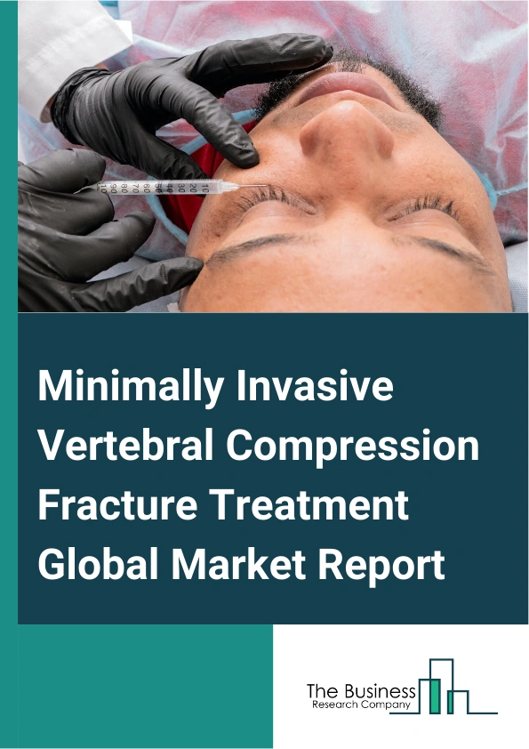 Minimally Invasive Vertebral Compression Fracture Treatment
