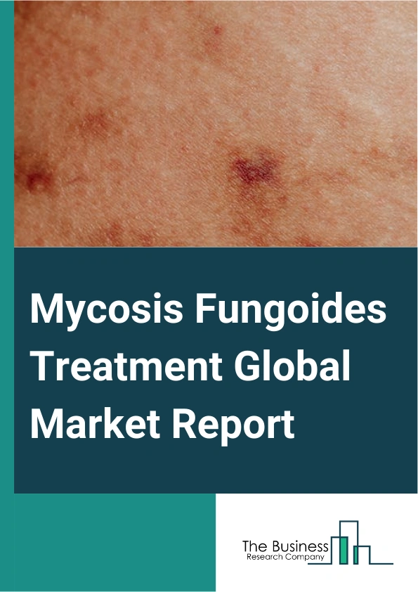 Mycosis Fungoides Treatment Global Market Report 2025 – By Drug Type (Topical Steroids, Mechlorethamine), By Treatment Type (Photodynamic Therapy, Radiation Therapy, Targeted Therapy, Chemotherapy), By End-user (Hospital...