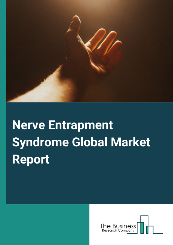 Global Nerve Entrapment Syndrome Market Report 2025
