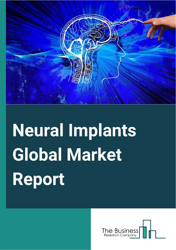 Neural Implants Global Market Report 2025 – By Product (F And B Spinal Cord Stimulation (SCS), Deep Brain Stimulation (DBS), Vagus Nerve Stimulation (VNS)), By Application (Chronic Pain, Parkinson’s Disease (PD), Epileps...