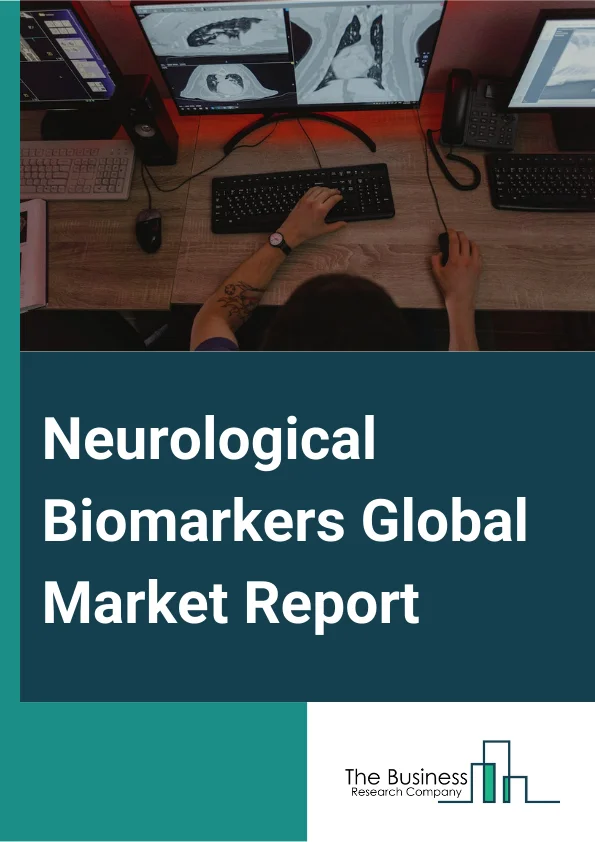 Neurological Biomarkers Global Market Report 2024 – By Product (Proteomics Biomarker, Genomics Biomarker, Metabolomics Biomarker, Imaging Biomarker, Other Products), By Application (Alzheimer’s Disease, Parkinson’s Disease, Huntington's Disease, Schizophrenia, Depression, Multiple Sclerosis, Spinal Muscular Atrophy), By End-User (Hospital Laboratories, Clinical Diagnostic Centers, Research Organizations, Other End-Users) – Market Size, Trends, And Global Forecast 2024-2033