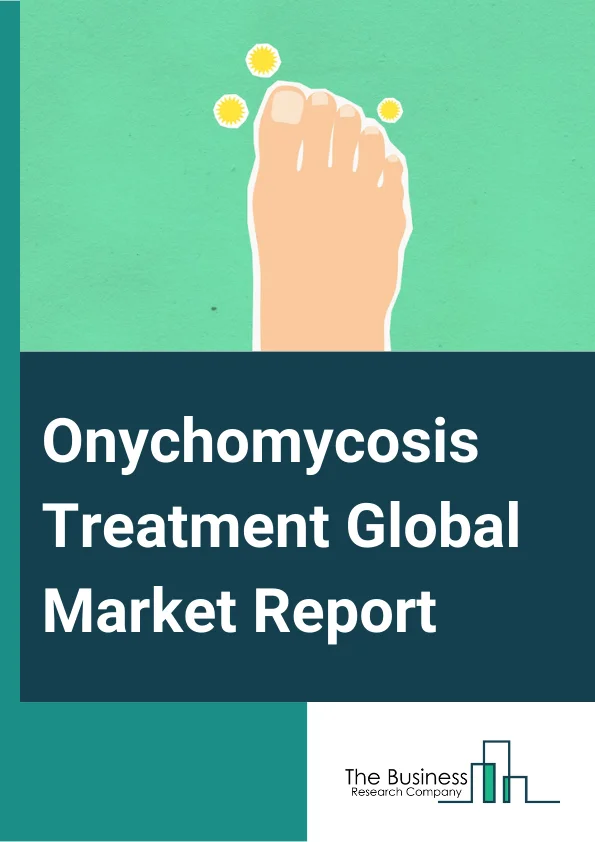 Onychomycosis Treatment Global Market Report 2025 – By Type (Distal Sublingual Onychomycosis, White Superficial Onychomycosis, Proximal Sublingual Onychomycosis, Candida Onychomycosis, Other Types), By Treatment Type (Drugs, Laser Therapy, Photodynamic Therapy), By Age Group (0 To 18 Years, 18 To 39 Years, 40 To 64 Years, 65 Years And Above), By Distribution Channel (Hospital Pharmacies, Retail Pharmacies, Other Distribution Channels) – Market Size, Trends, And Global Forecast 2025-2034