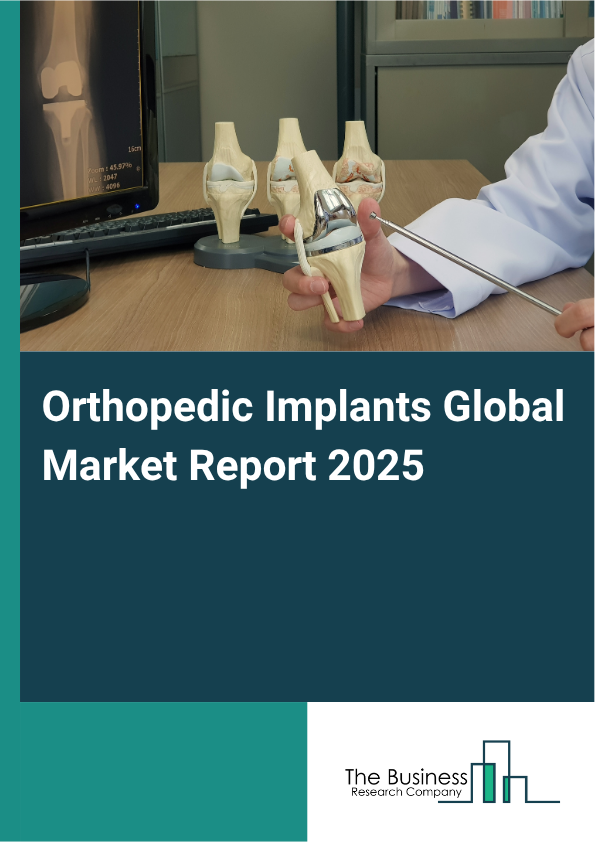 Orthopedic Implants Market Report Infographic Image