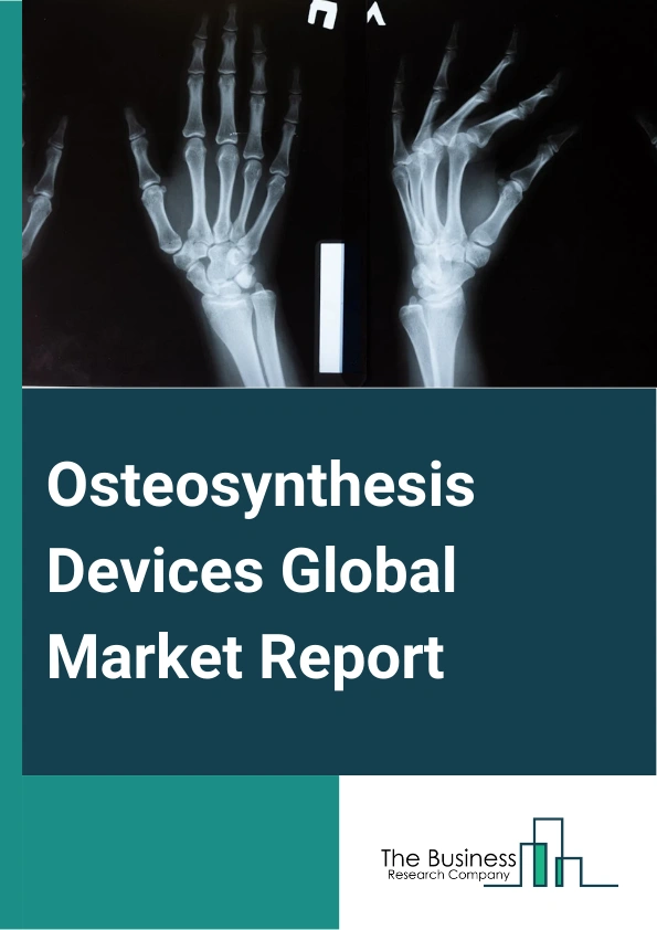 Osteosynthesis Devices Global Market Report 2024 – By Device Type (Internal Fixation Devices, External Fixation Devices), By Fracture Type (Hip Fracture, Knee Fracture, Spine Fracture, Shoulder Fracture, Foot And Ankle Fracture, Facial Bones Fracture, Other Fracture Types), By Material (Non-Degradable, Degradable), By End User (Hospitals, Orthopedic Clinics, Ambulatory Surgical Centers) – Market Size, Trends, And Global Forecast 2024-2033