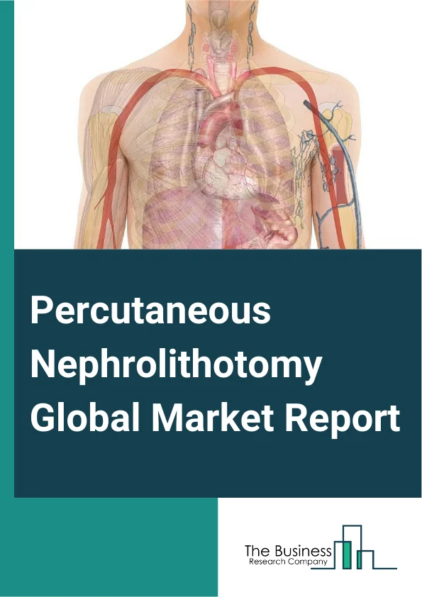 Percutaneous Nephrolithotomy Global Market Report 2025 – By Type (Magnesium Ammonium Phosphate Stone Type, Calcareous Type, Uric Acid Calculi Type), By Component (Accessories, Devices, Services), By End-User (Ambulatory Surgical Centers, Clinics, Hospitals) – Impact of Tariff and Trade War on Market Size, Growth, Trends, and Forecast 2025–2034