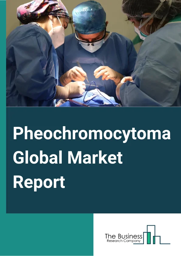 Pheochromocytoma Global Market Report 2024 – By Type (Adrenal Pheochromocytoma, Extra-Adrenal Pheochromocytoma), By Treatment (Medication, Surgery, Radionuclide Treatment, Other Treatments), By Diagnosis (Laboratory Tests, Imaging Tests, Genetic Testing), By End Users (Hospitals, Clinics, Research And Academic Institutes, Other End Users) – Market Size, Trends, And Global Forecast 2024-2033