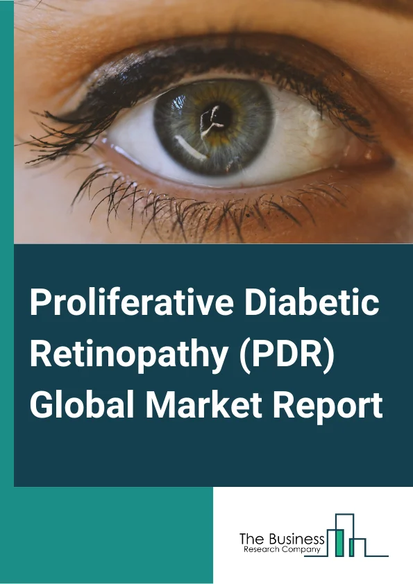 Proliferative Diabetic Retinopathy PDR