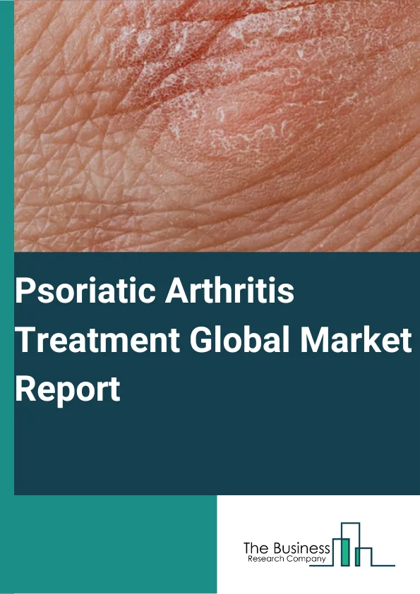 Psoriatic Arthritis Treatment