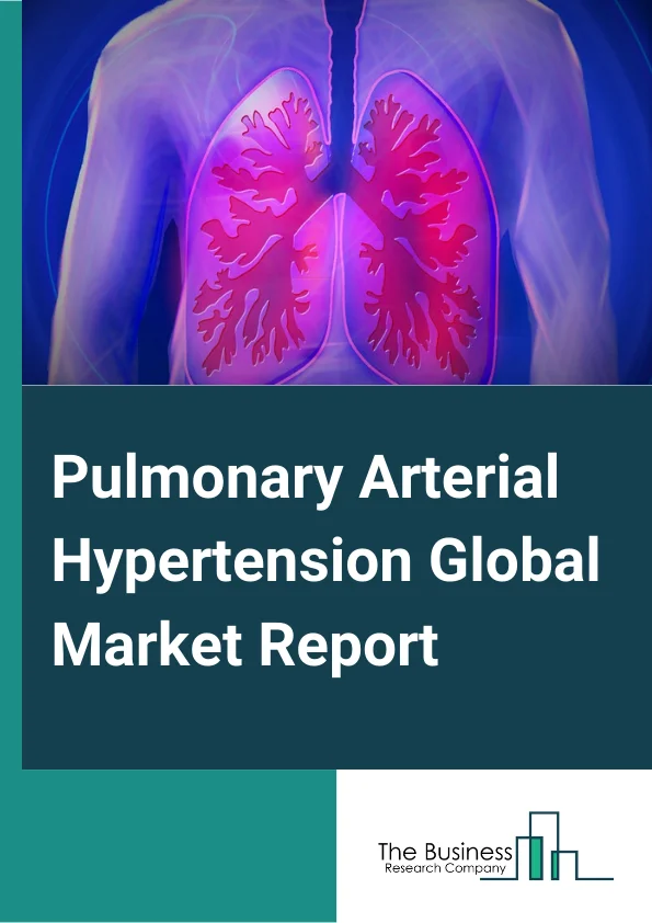 Pulmonary Arterial Hypertension Global Market Report 2024 – By Drug Class (Endothelin Receptor Antagonists (ERAs), PDE-5 Inhibitors, Prostacyclin and Prostacyclin Analogs, SGC Stimulators), By Route of Administration (Oral, Intravenous/ subcutaneous, Inhalational), By Distribution channel (Retail, Online) – Market Size, Trends, And Global Forecast 2024-2033
