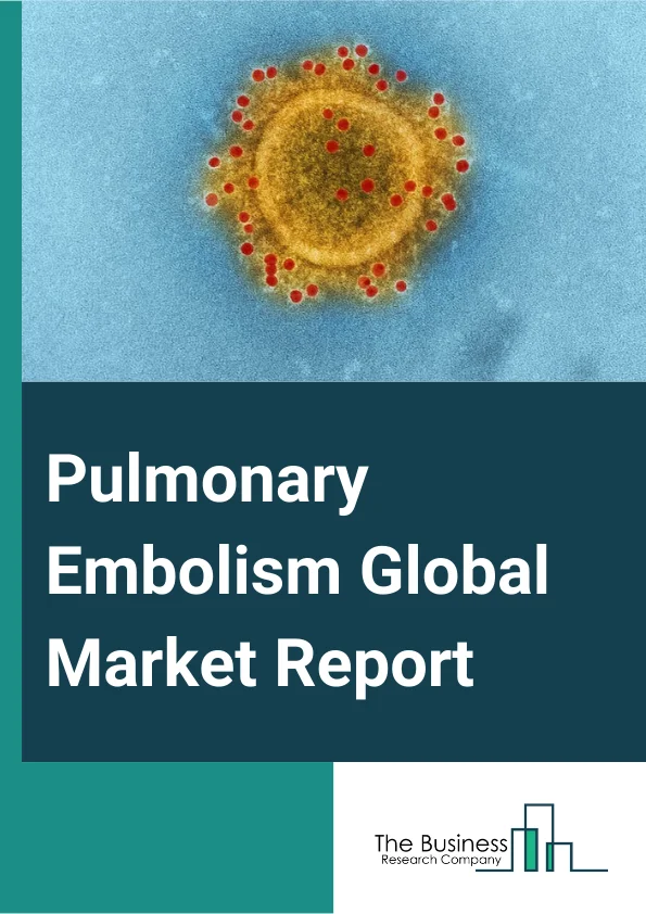 Pulmonary Embolism Global Market Report 2025 – By Treatment (Medications, Mechanical Devices, Other Treatments), By Diagnosis (Chest X-Ray, Electrocardiogram (ECG), Magnetic Resonance Imaging (MRI), Computed Tomography S...