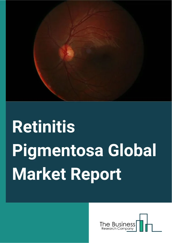Retinitis Pigmentosa Global Market Report 2025 – By Type (Autosomal Recessive, Autosomal Dominant, X-Linked), By Treatment (Vitamin A, Docosahexaenoic Acid (DHA), Calcium Channel Blockers, Gene Therapy, Retinal Eye Prost...