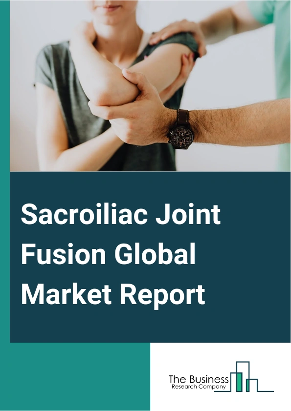 Sacroiliac Joint Fusion Global Market Report 2025 – By Product (Implants, Accessories, Injections, Diagnosis, Treatment, RF Ablation), By Indication Type (Degenerative Sacroiliitis, Sacral Disruption, Trauma), By Approac...