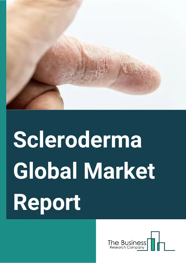 Scleroderma Global Market Report 2024 – By Treatment (Medication, Surgery, Other Treatments), By Indication (Systemic Scleroderma, Localized Scleroderma), By End User (Hospital, Pharmaceutical Stores, Other End Users) – Market Size, Trends, And Global Forecast 2024-2033