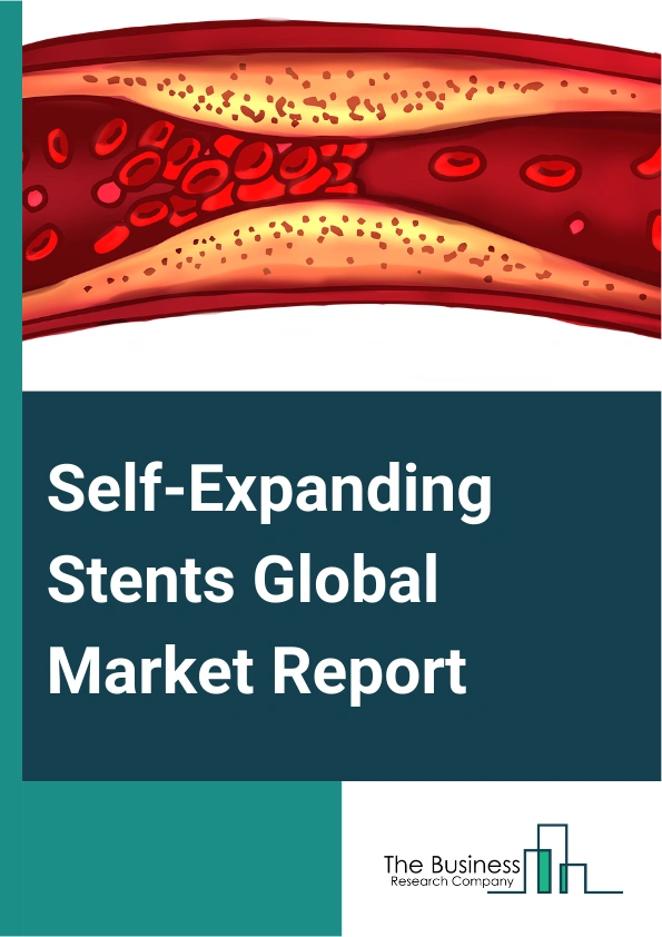 Self-Expanding Stents Global Market Report 2025 – By Product Type (Gastrointestinal Self-Expanding Stents, Carotid Self-Expanding Stents, Endovascular Self-Expandable Stents, Other Product Types), By Applications (Fem-Po...