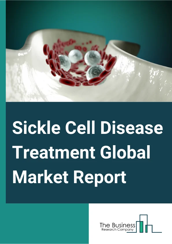 Sickle Cell Disease Treatment