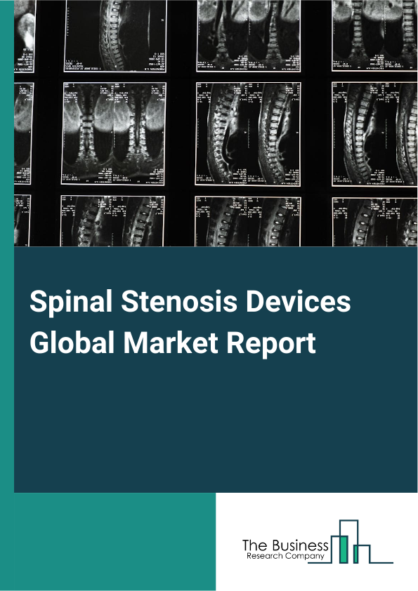 Spinal Stenosis Devices