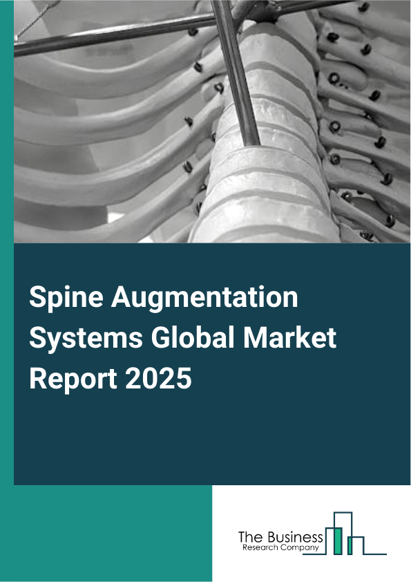 Global Spine Augmentation Systems Market Report 2025