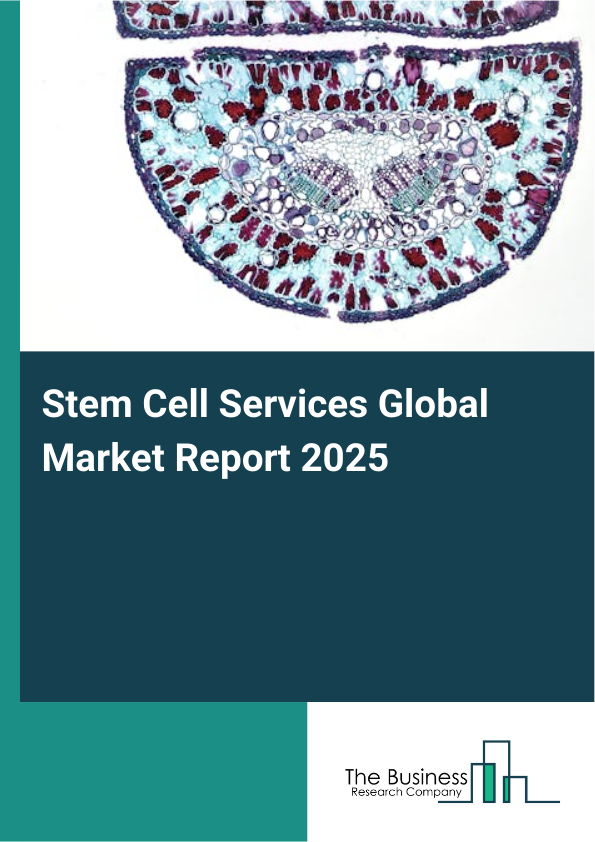 Global Stem Cell Services Market Report 2025