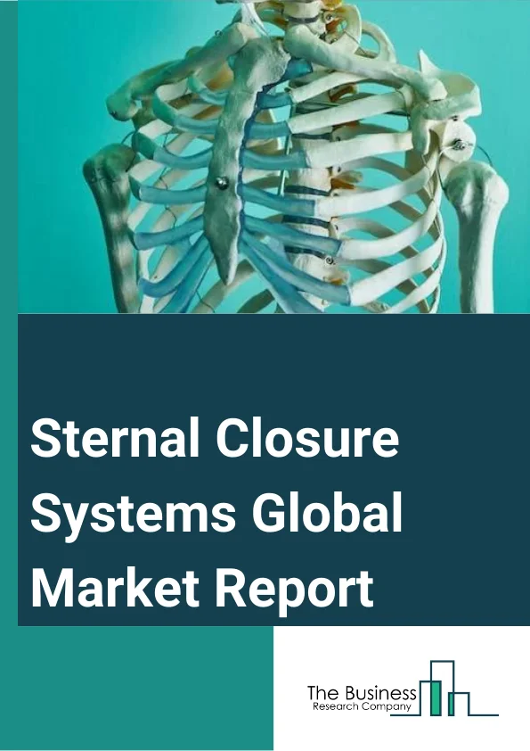 Sternal Closure Systems