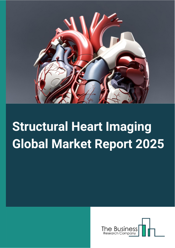Global Structural Heart Imaging Market Report 2025