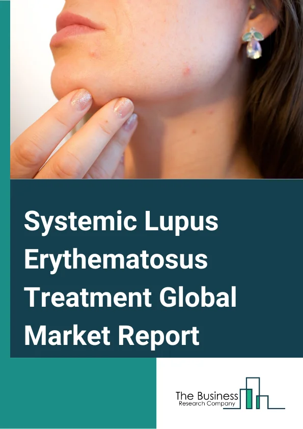 Systemic Lupus Erythematosus Treatment Global Market Report 2024 – By Drug (Antimalarial Drugs, Non-Steroidal Anti-Inflammatory Drugs (NSAIDS), Corticosteroids, Immunosuppressive Drugs), By Route Of Administration (Sub-Cutaneous, Oral, Intravenous ), By Application (Hospital Pharmacies, Retail Pharmacies, Online Sales) – Market Size, Trends, And Global Forecast 2024-2033