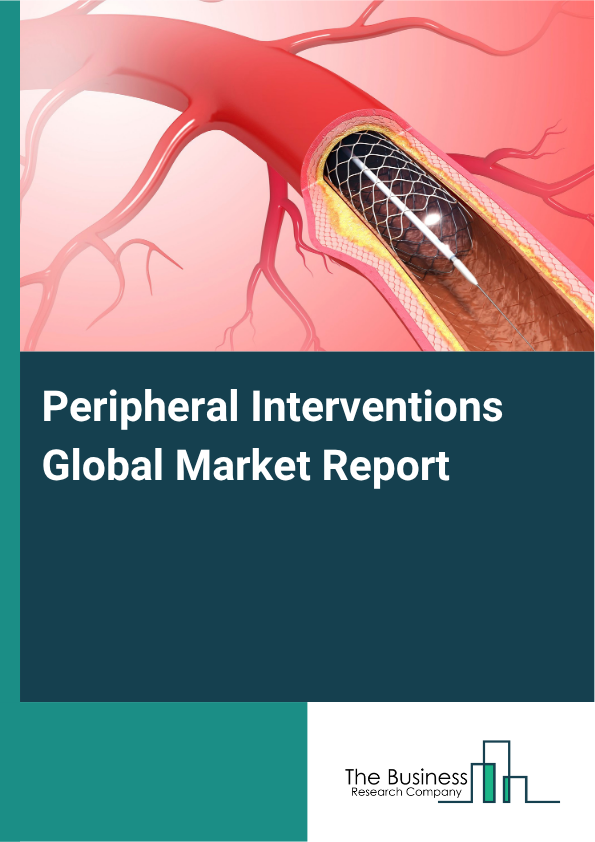 Global Telecare Market Report 2025