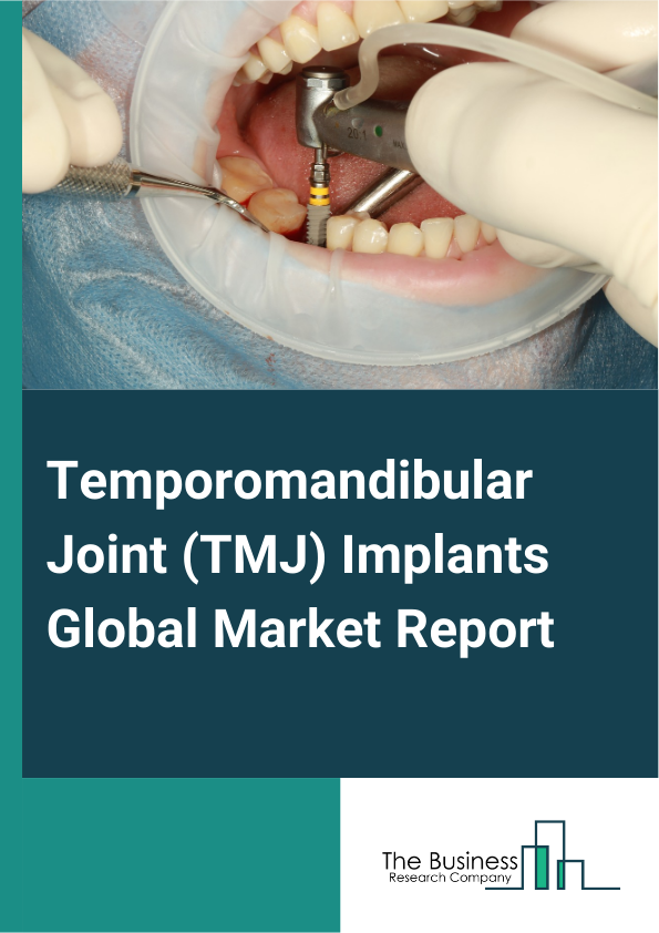 Temporomandibular Joint (TMJ) Implants Global Market Report 2025 – By Components (Mandibular Components, Fossa Prosthesis, Screws), By Material (Cobalt-Chromium-Molybdenum, Titanium Alloy, Ultra-High Molecular Weight Pol...