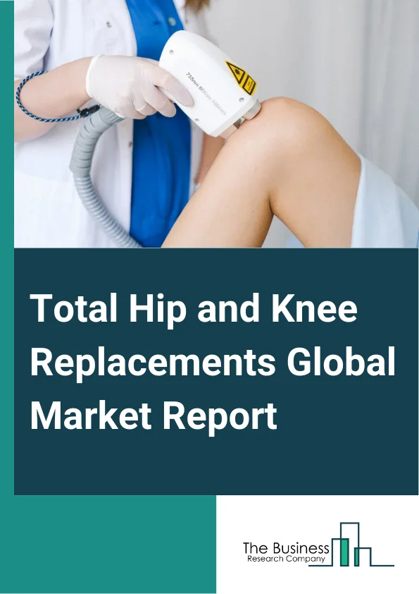 Total Hip and Knee Replacements Global Market Report 2024 – By Procedure Type (Total Hip Replacement, Partial Hip Replacement, Revision Hip Replacement, Total Knee Replacement, Partial Knee Replacement, Revision Knee Replacement), By Implant Type (Mobile Bearing, Fixed Bearing, Other Implant Types), By End-User (Hospitals, Ambulatory Surgical Centers, Orthopedic Clinics, Other End-Users) – Market Size, Trends, And Global Forecast 2024-2033
